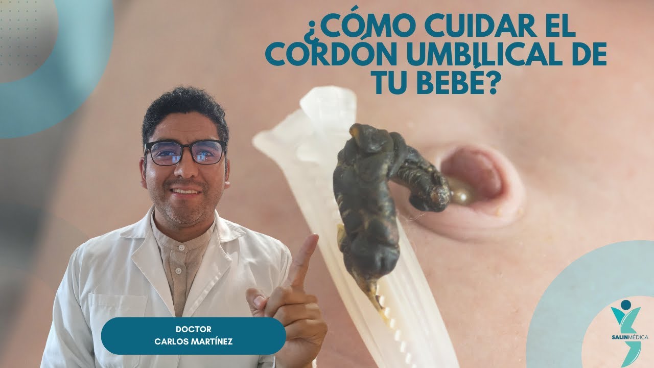 ¿Cómo cuidar el cordón umbilical en tu bebé recién nacido?