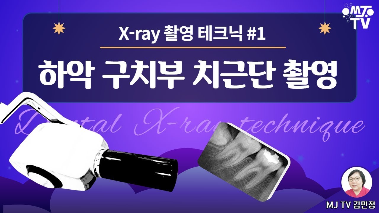 MJTV(엠제이티비) 17화-#치과위생사라면 꼭 알아야 할 #X-ray 촬영 테크닉 -1 하악 구치부 #치근단 촬영 방법