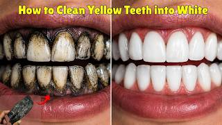 How To Clean Yellow Teeth Into White | DIY Teeth Whitening Guide