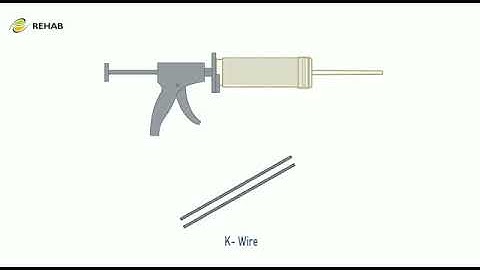 Advantage Bone Cement Spacer