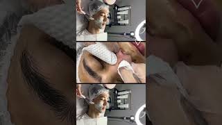 #skincare #эстетическая #контурнаяпластика #makeup #уходзажирнойкожей #beauty