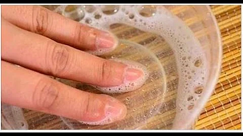O que causa rachaduras nas pontas dos dedos das mãos?