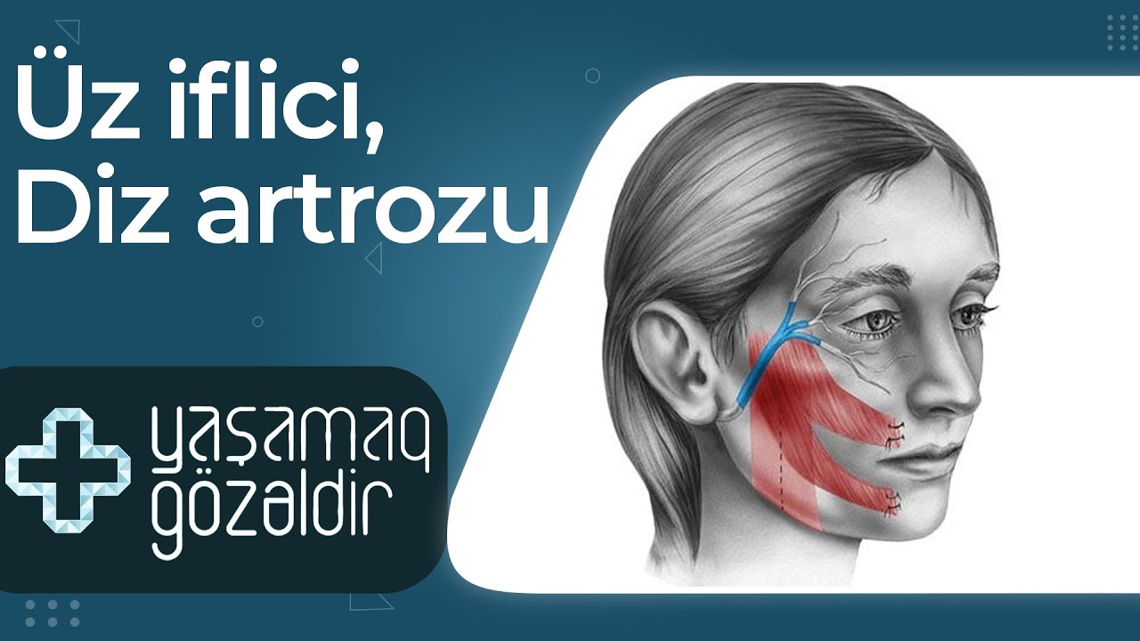 Üz iflici, Diz artrozu - Musa Kılıç, Ağaməzahir Ağazadə  - 01.06.2022 - Yaşamaq Gözəldir