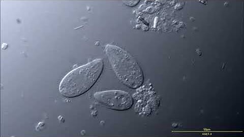 Small Marine Ciliates (ciliophora) - Structure: cilia, macronucleus, vacuoles (DIC microscopy) (4K)