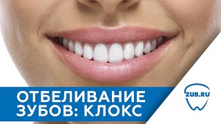 Отбеливание зубов системой KLOX | Механизм отбеливания зубов | Cтоматология Зуб.ру