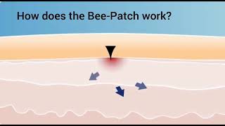 Bee-Patch - How does it work