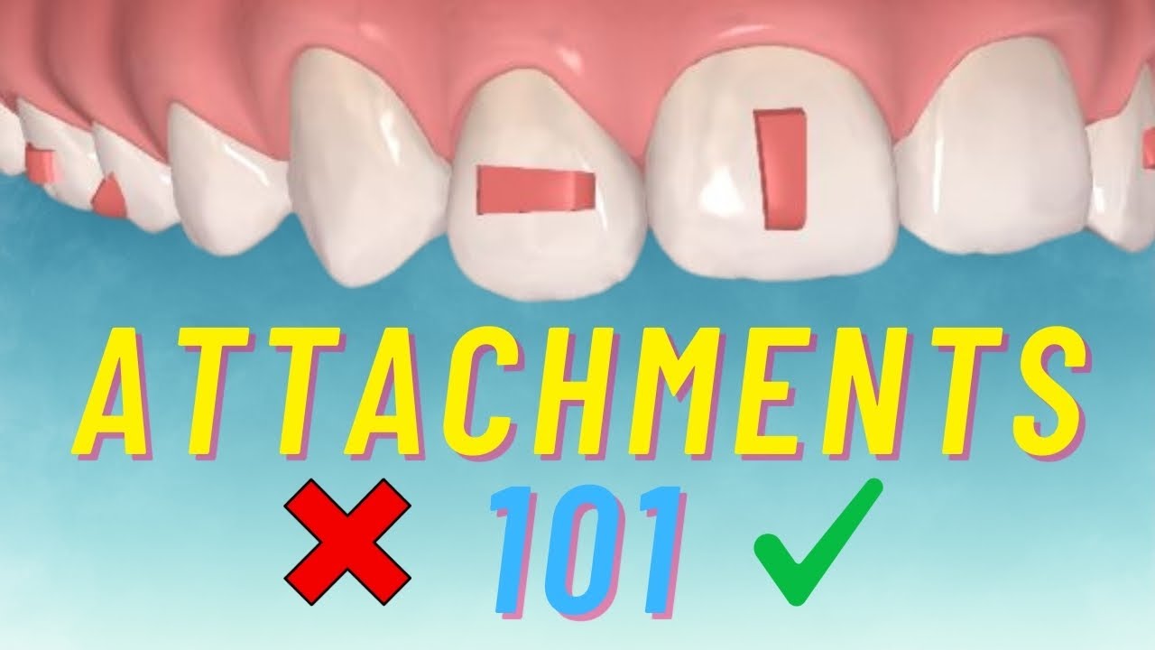 Top 5 Invisalign Attachment Tips for Dentists | Clincheck ®