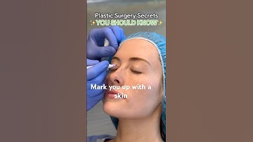 Why Do Surgeons Draw On You? 🤔