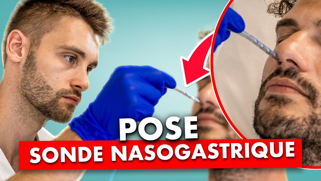 Pose de sonde nasogastrique : technique, étapes et erreurs à éviter - soin infirmier