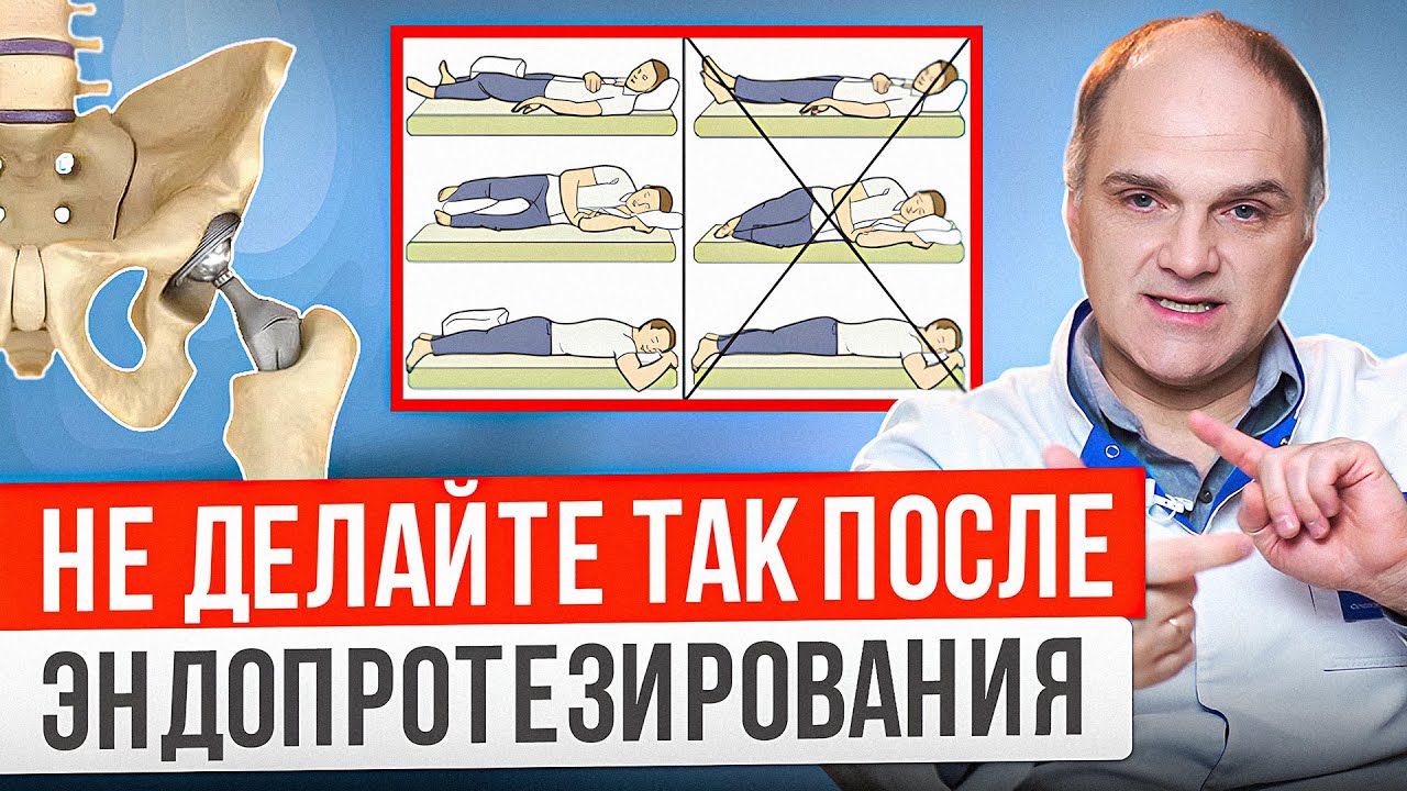 5 ограничений после замены тазобедренного сустава. Ваша жизнь измениться после эндопротезирования.
