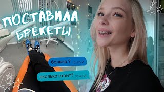 ПОСТАВИЛА БРЕКЕТЫ ⭐︎ больно? сколько стоит? // НЕДЕЛЯ С БРЕКЕТАМИ // отвечаю на вопросы