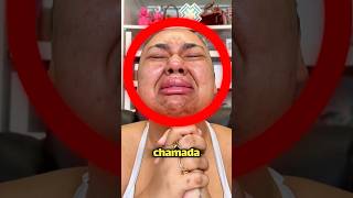Ela Não Aguentava Mais Ser Chamada De Feia💔