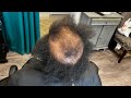 She hasn’t combed her hair in over 20 years | she cut her dreds off