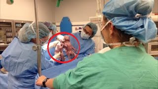 Seconds after Giving Birth, the OBGYN’s Jaw Dropped Because He Saw This!