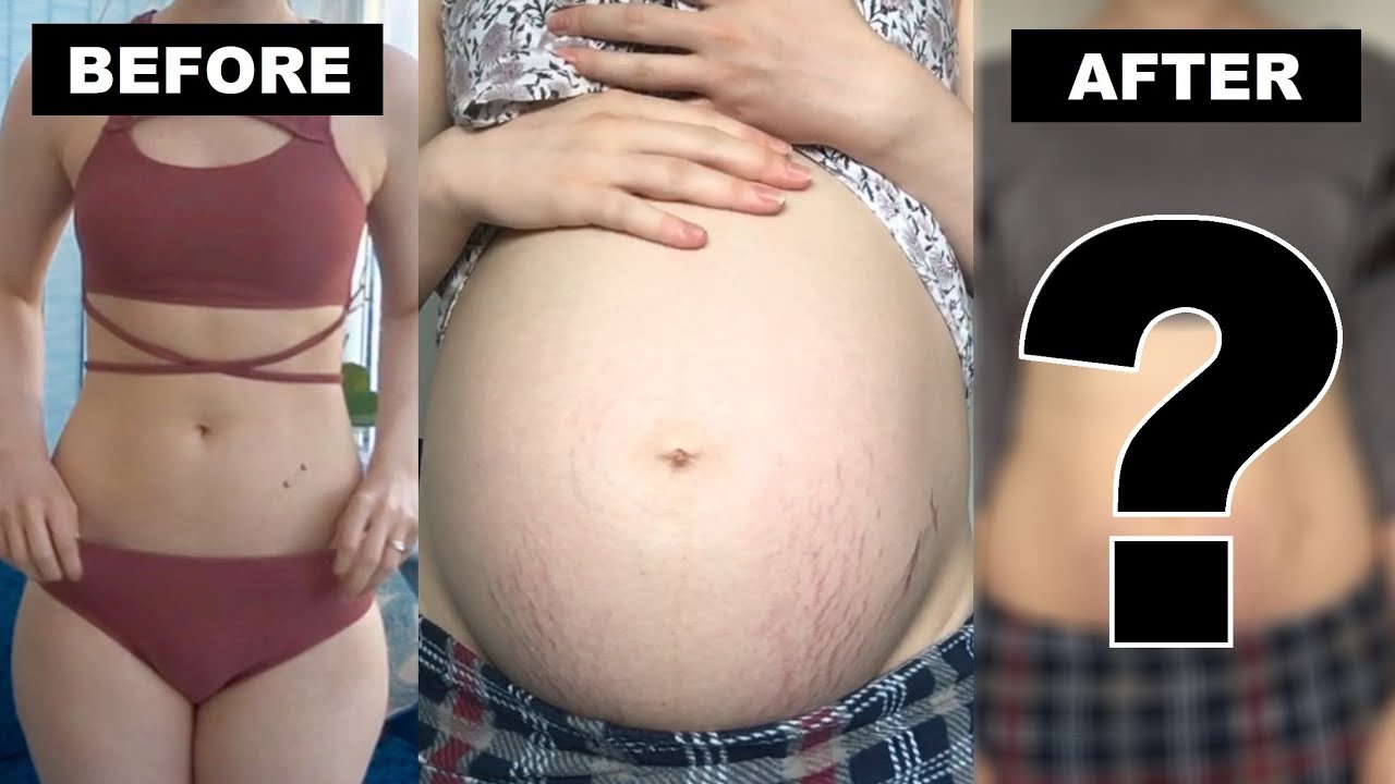 What My Stomach Looks Like After Giving Birth Thetarative Youtube