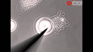 Imina Technologies: Interaction with a single cell