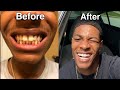 Byte Update | I got a bag and fixed my teeth!!