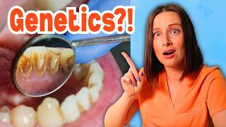 Is Gum Disease Inherited?! Genetics VS Environment