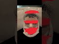 Surgery transformation