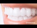 ONOSONIC Best Electric Toothbrush you can buy now!