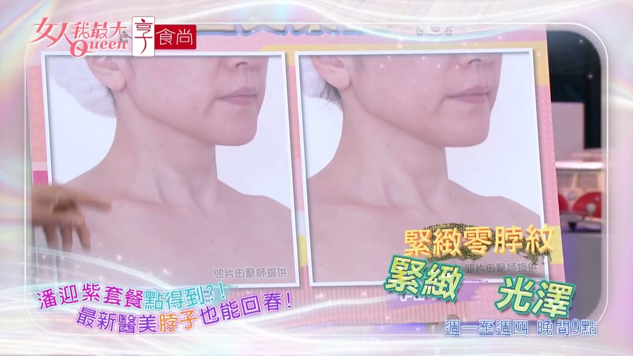 最新醫美技術 讓你凍齡如潘迎紫？！ #女人我最大 20251104(預告)