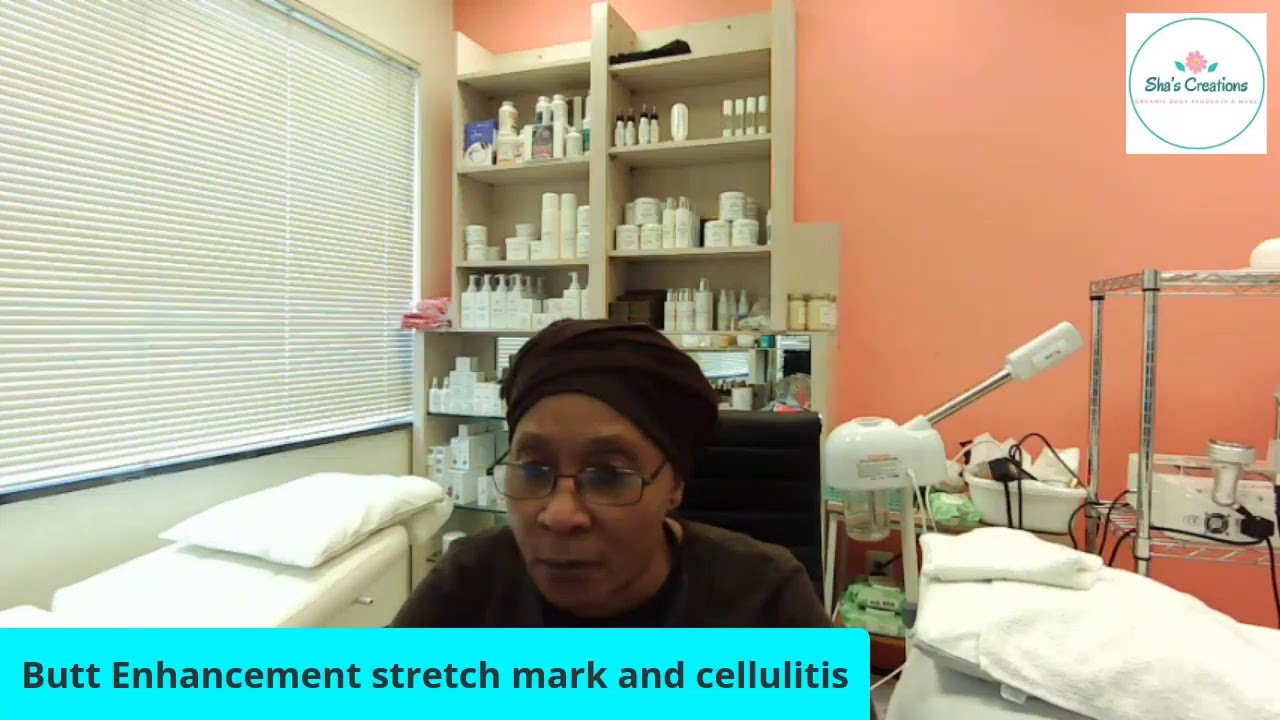 Buttocks enhancement and slimming stretch marks, cellulitis.