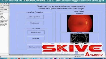 Simple methods for segmentation and measurement of diabetic retinopathy lesions