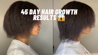 FAST HAIR GROWTH using ​⁠@Shedavi  Hair Growth Vitamins and Oil