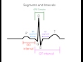 Mastering EKG Interpretation Through Heart Conduction Insights