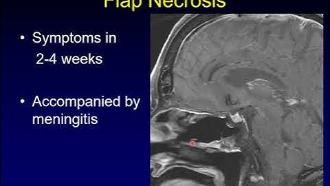 Complications of Skull Base Surgery, Part 1