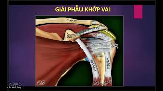 CKI CĐHA 2020 - MRI Khớp vai