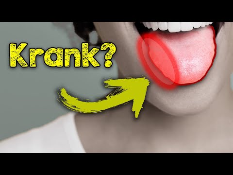 Die Zunge sieht so aus? Was das für die Gesundheit bedeutet