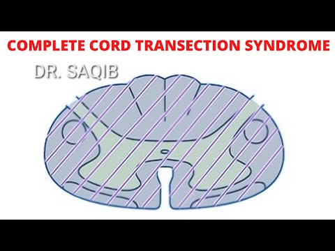 Video: U potpunoj transekciji leđne moždine?