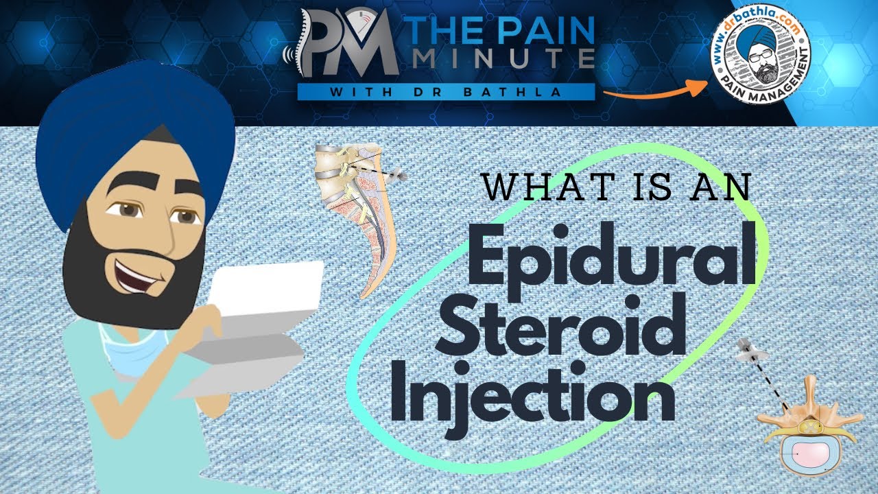 Epidural Steroid Injections | What is Involved | Epidural Steroid Injections Procedure For Back Pain