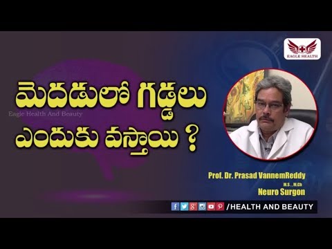 మెదడులో గడ్డలు ఎందుకు వస్తాయి | All you Need to Know About Brain Tumors | Eagle Health