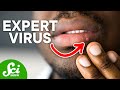 Why Herpes Is Different From Other Viruses Why Herpes Is Different From Other Viruses