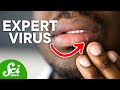 Why Herpes Is the Most Talented Virus Ever