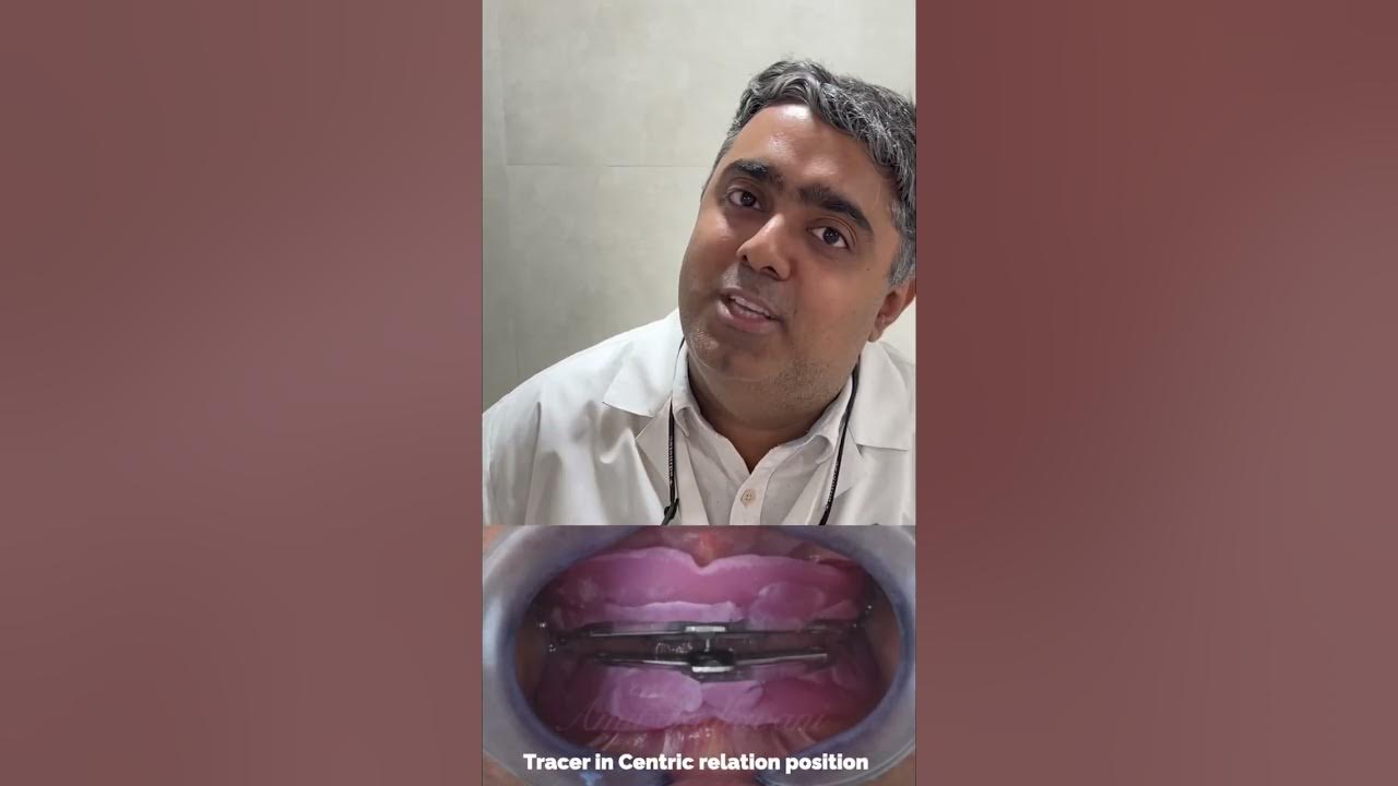 Comprehensive Removable Prosthodontics (CRP) What is it ? YouTube