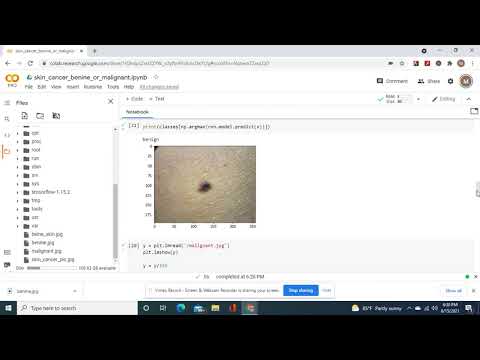 Skin Cancer Image Classification with two methods of prediction with the 2nd method both were right.