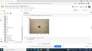 Skin Cancer Image Classification with two methods of prediction with the 2nd method both were right.