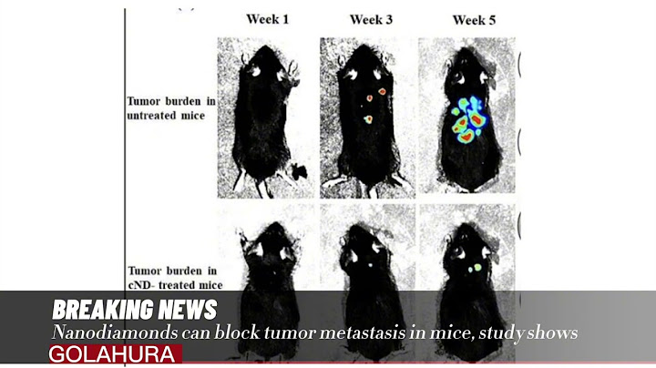 B16f-10 melanoma-bearing c57bl 6 mice là gì