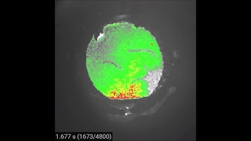 Monolayer of neonatal mouse ventricular myocyte stained with voltage sensitive dye