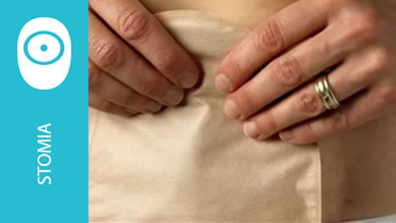 Come applicare il dispositivo per stomia due pezzi SenSura Click