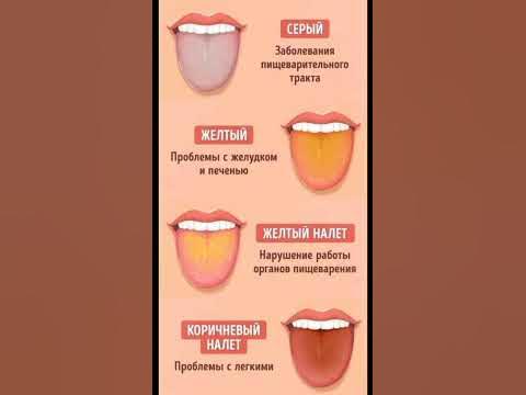 12 ПРОБЛЕМ, О КОТОРЫХ МОЖЕТ РАССКАЗАТЬ ЦВЕТ ЯЗЫКА - YouTube