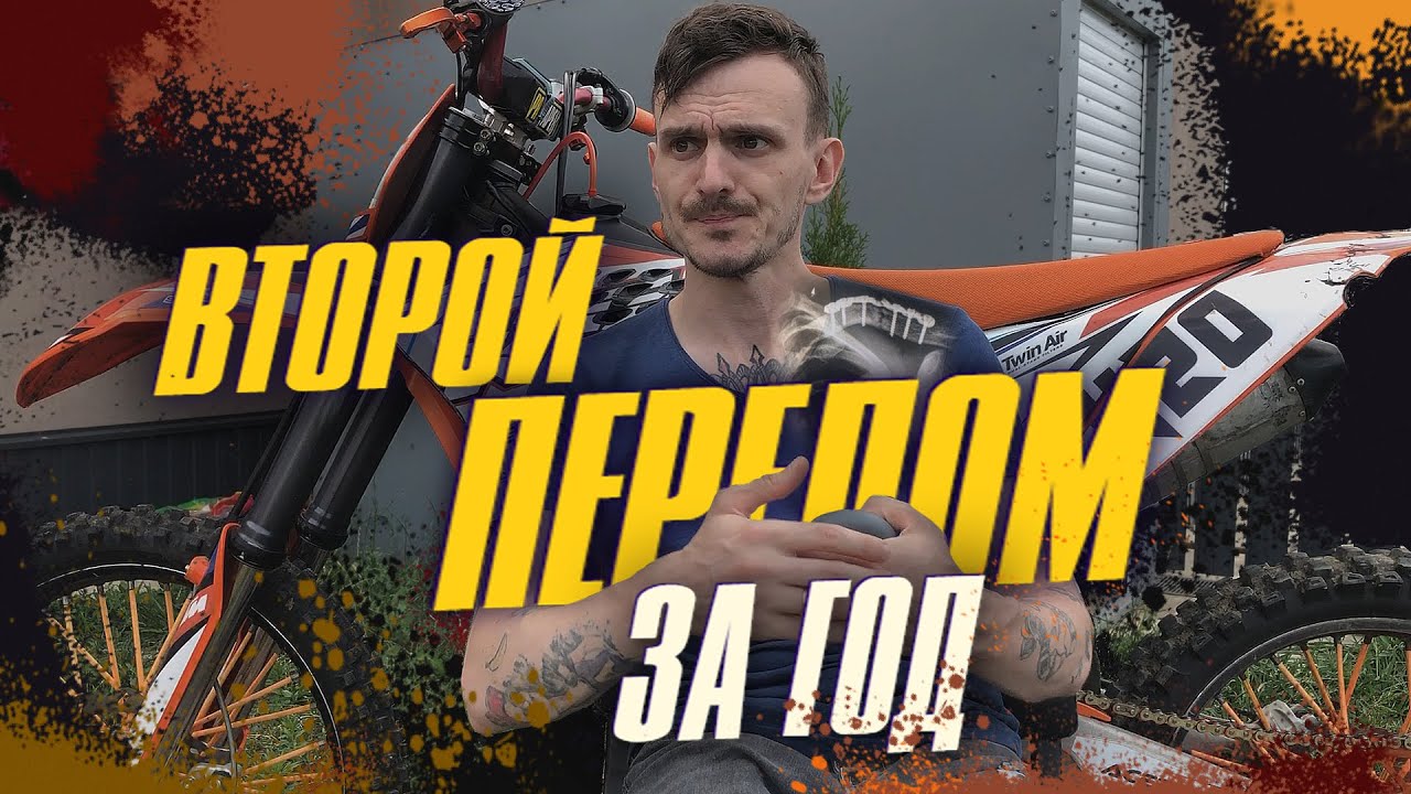 Перелом ключицы с пластиной, второй раз за год. - YouTube