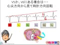 出直し看護塾1-15_移行帯