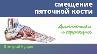 СТОПА | Смещение пяточной кости | Визуальная диагностика и коррекция Кинезиология | Дмитрий Кущик