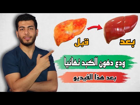 فيديو: 3 طرق لعكس دهون الكبد