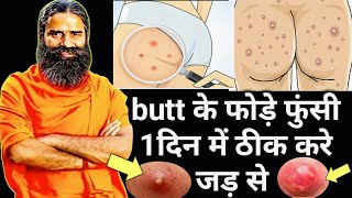 How to cure boils, spots, itching rashes on the hips, #buttacne #hipspardane #hipskefode #putta screenshot 1