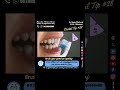 Brush your gums too (gently)
